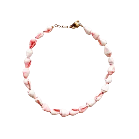 Seashell Anklets